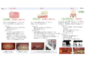 インプラントと入れ歯、どちらが良い？ 〜ブリッジも含めた、失った歯の治療法の選び方〜